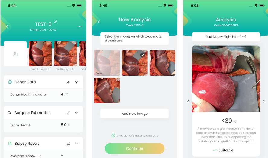 diagnostics_livercolor.png